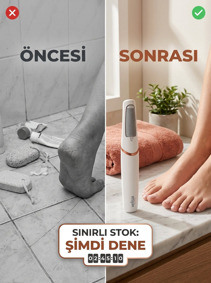 Velissa PediPro Elektrikli Nasır Cihazı 7