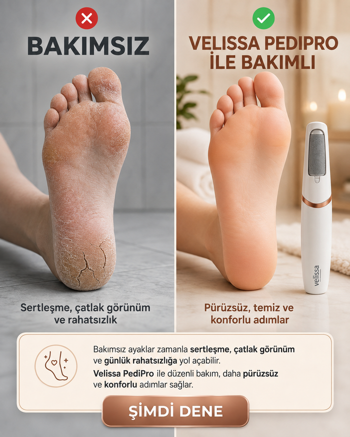 Velissa PediPro Elektrikli Ayak Bakım Cihazı